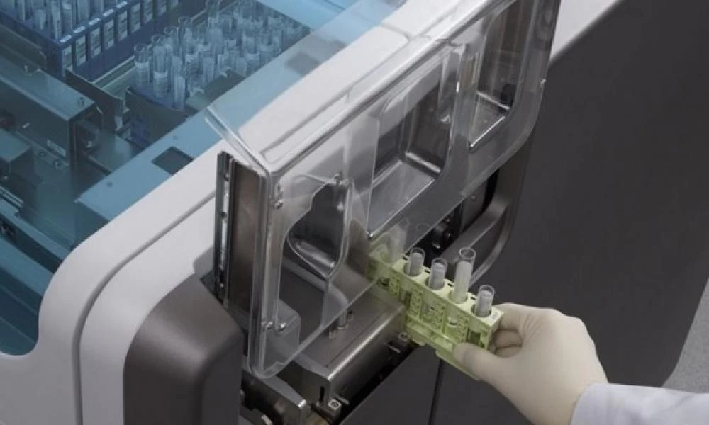 Bloomberg: Νέο τεστ για τον κορωνοϊό είναι δέκα φορές ταχύτερο από τα προηγούμενα!